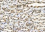 PRKAR1B Antibody in Immunohistochemistry (Paraffin) (IHC (P))