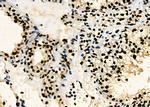 PRKAR1B Antibody in Immunohistochemistry (Paraffin) (IHC (P))