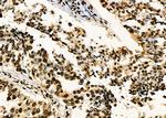 PRKAR1B Antibody in Immunohistochemistry (Paraffin) (IHC (P))