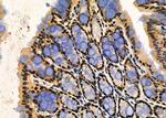 PRKAR1B Antibody in Immunohistochemistry (Paraffin) (IHC (P))