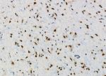 PRKAR1B Antibody in Immunohistochemistry (Paraffin) (IHC (P))