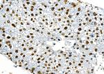 PRKAR1B Antibody in Immunohistochemistry (Paraffin) (IHC (P))