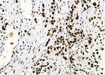 PRKAR1B Antibody in Immunohistochemistry (Paraffin) (IHC (P))