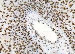 PRKAR1B Antibody in Immunohistochemistry (Paraffin) (IHC (P))