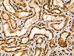 CIITA Antibody in Immunohistochemistry (Paraffin) (IHC (P))