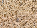 CIITA Antibody in Immunohistochemistry (Paraffin) (IHC (P))