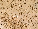 CIITA Antibody in Immunohistochemistry (Paraffin) (IHC (P))