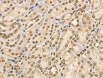 CIITA Antibody in Immunohistochemistry (Paraffin) (IHC (P))