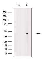 TIS11D Antibody in Western Blot (WB)