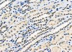 HOXA1 Antibody in Immunohistochemistry (Paraffin) (IHC (P))