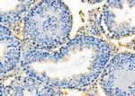 HOXA1 Antibody in Immunohistochemistry (Paraffin) (IHC (P))