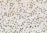 HOXA1 Antibody in Immunohistochemistry (Paraffin) (IHC (P))