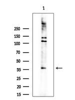 HOXA1 Antibody in Western Blot (WB)