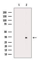 DLX5 Antibody in Western Blot (WB)