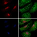 IRX1 Antibody in Immunocytochemistry (ICC/IF)