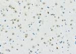 ADARB1 Antibody in Immunohistochemistry (Paraffin) (IHC (P))