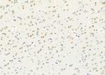 ADARB1 Antibody in Immunohistochemistry (Paraffin) (IHC (P))