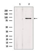 ADARB1 Antibody in Western Blot (WB)