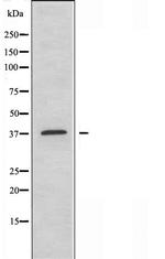 MEF2B Antibody in Western Blot (WB)