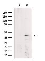 MVK Antibody in Western Blot (WB)