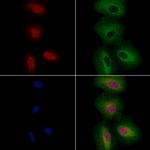 FOXC1/FOXC2 Antibody in Immunocytochemistry (ICC/IF)