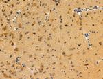 FOXC1/FOXC2 Antibody in Immunohistochemistry (Paraffin) (IHC (P))