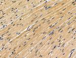 FOXC1/FOXC2 Antibody in Immunohistochemistry (Paraffin) (IHC (P))