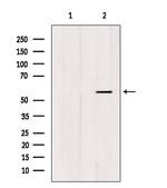 FOXC1/FOXC2 Antibody in Western Blot (WB)