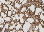 JIP2 Antibody in Immunohistochemistry (Paraffin) (IHC (P))