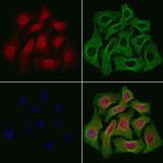 p35 Antibody in Immunocytochemistry (ICC/IF)