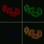 p35 Antibody in Immunocytochemistry (ICC/IF)