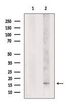 p35 Antibody in Western Blot (WB)