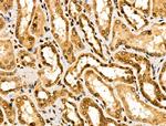 ASC1 Antibody in Immunohistochemistry (Paraffin) (IHC (P))