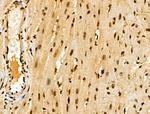 ASC1 Antibody in Immunohistochemistry (Paraffin) (IHC (P))