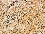 ASC1 Antibody in Immunohistochemistry (Paraffin) (IHC (P))