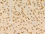 ASC1 Antibody in Immunohistochemistry (Paraffin) (IHC (P))