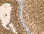 ASC1 Antibody in Immunohistochemistry (Paraffin) (IHC (P))