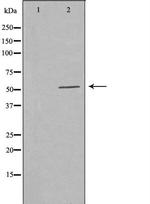 PFKFB1/PFKFB4 Antibody in Western Blot (WB)