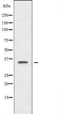 CTU1 Antibody in Western Blot (WB)