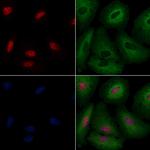 DBC1 Antibody in Immunocytochemistry (ICC/IF)