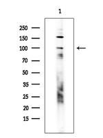 DBC1 Antibody in Western Blot (WB)