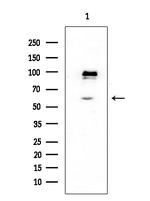 DBC1 Antibody in Western Blot (WB)