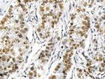 SMARCC2 Antibody in Immunohistochemistry (Paraffin) (IHC (P))