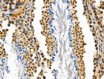 SMARCC2 Antibody in Immunohistochemistry (Paraffin) (IHC (P))