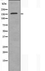 SMARCC2 Antibody in Western Blot (WB)