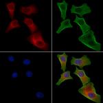 EPS8L1 Antibody in Immunocytochemistry (ICC/IF)