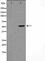 CUGBP1 Antibody in Western Blot (WB)