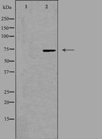 BRF1 Antibody in Western Blot (WB)