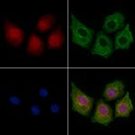 ITPKC Antibody in Immunocytochemistry (ICC/IF)