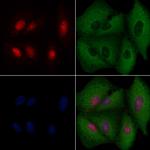 BRMS1 Antibody in Immunocytochemistry (ICC/IF)